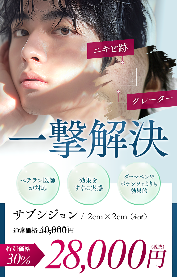 ニキビ跡、クレーターを確実に改善
